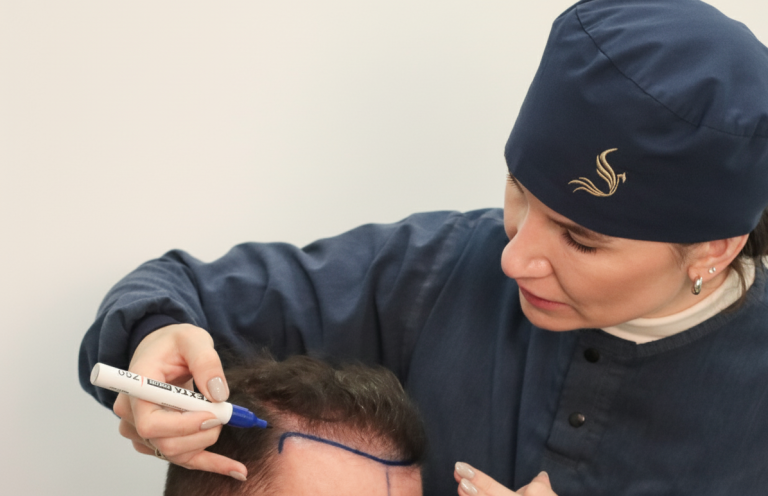 Médica realizando marcações na cabeça do paciente.